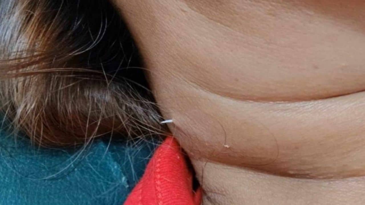 [IMG: a fishy neck in one of the images posted to Facebook]