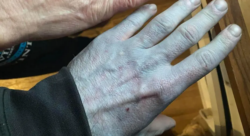 [IMG: Lynch shows a camera an azure hand]