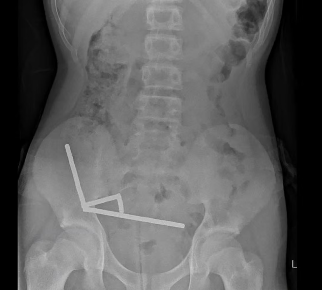 [IMG: The
x-rays, magnets all in rows]