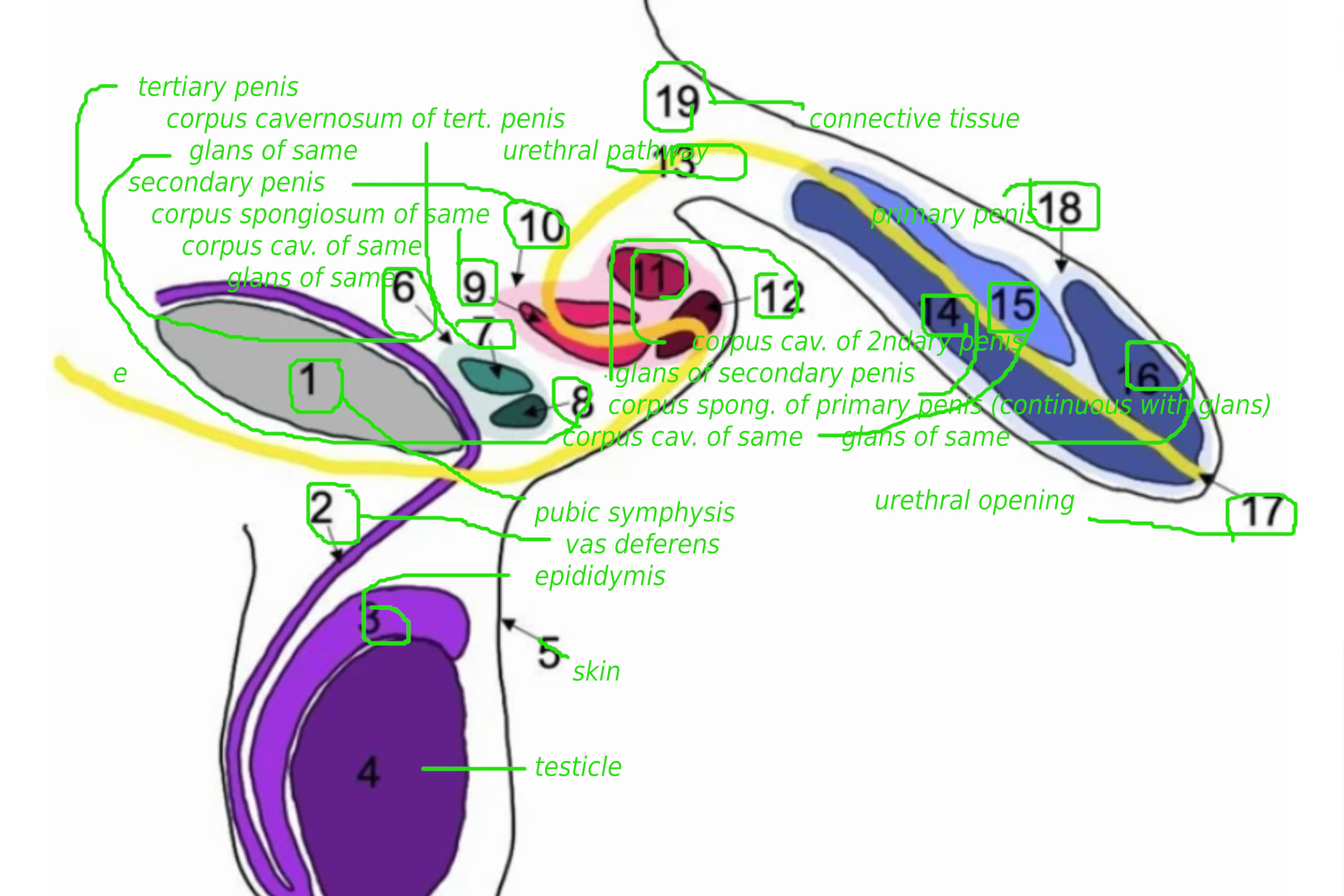 [IMG: the paper's diagram of the penile morphological abnormalities, with my vomit-green mark up]